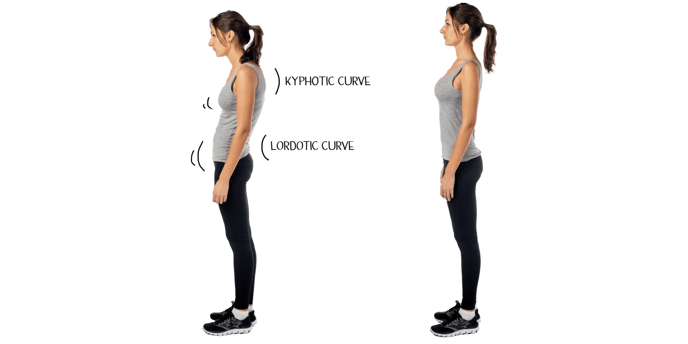 kyphosis and lordosis